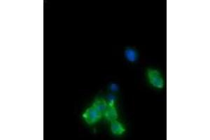 Image no. 2 for anti-Cancer/testis Antigen 1B (CTAG1B) antibody (ABIN1499898) (CTAG1B antibody)