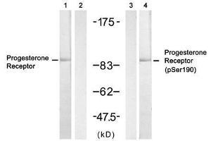 Western blot analysis of extract from SKOV3 cell untreated or treated with insulin, using Progesterone Receptor (Ab- 190) antibody (E021069, Lane 1 and 2) and Progesterone Receptor (phospho-Ser190) antibody (E011074, Lane 3 and 4). (Progesterone Receptor antibody  (pSer190))