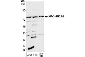 Western Blotting (WB) image for anti-Kinesin Family Member C1 (KIFC1) (AA 1-50) antibody (ABIN7453560) (KIFC1 antibody  (AA 1-50))