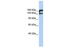 WB Suggested Anti-TOP2B  Antibody Titration: 0. (TOP2B antibody  (Middle Region))
