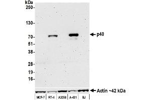 Western Blotting (WB) image for anti-p40 (p63 Delta) (AA 1-50) antibody (ABIN7449374) (p40 (p63 Delta) (AA 1-50) antibody)