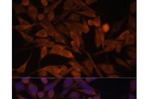Immunofluorescence analysis of HeLa cells using CACYBP Polyclonal Antibody at dilution of 1:100. (CACYBP antibody)