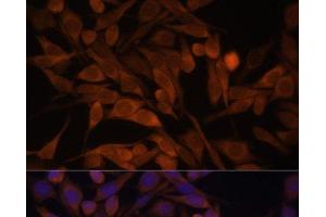 Immunofluorescence analysis of HeLa cells using CACYBP Polyclonal Antibody at dilution of 1:100. (CACYBP antibody)