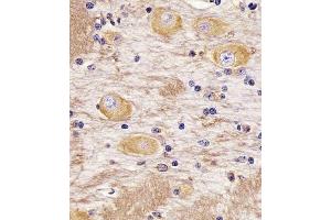 (ABIN388782 and ABIN2839114) staining TAU in Cynomolgus Monkey brain tissue sections by Immunohistochemistry (IHC-P - paraformaldehyde-fixed, paraffin-embedded sections). (tau antibody  (C-Term))