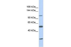 WB Suggested Anti-SLC39A10 Antibody Titration:  0. (SLC39A10 antibody  (N-Term))