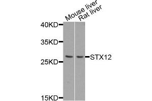 Western blot analysis of extract of mouse liver and rat liver cells, using STX12 antibody. (Syntaxin 12 antibody)