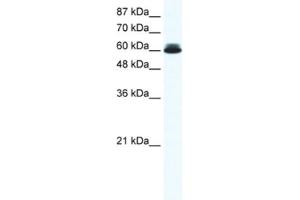 Western Blotting (WB) image for anti-DEAD (Asp-Glu-Ala-Asp) Box Polypeptide 27 (DDX27) antibody (ABIN2461352) (DDX27 antibody)