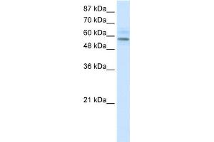 WB Suggested Anti-MGC4618 Antibody   Titration: 1.