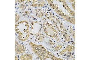 Immunohistochemistry of paraffin-embedded human kidney using N6AMT1 Antibody (ABIN5974334) at dilution of 1/100 (40x lens). (N6AMT1 antibody)