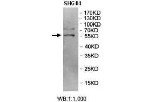 Western blot analysis of SHG44 cell Lysate using BRD9 Antibody.