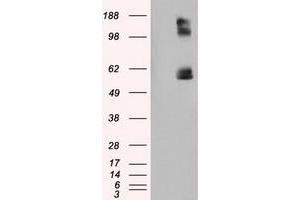 Image no. 6 for anti-Lipase, Endothelial (LIPG) antibody (ABIN1499176)