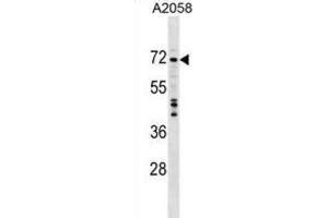 Western Blotting (WB) image for anti-DEAD (Asp-Glu-Ala-Asp) Box Polypeptide 56 (DDX56) antibody (ABIN2999360)