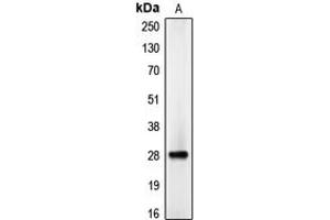 Western blot analysis of C/EBP delta/epsilon expression in HepG2 (A) whole cell lysates. (C/EBP delta/epsilon (C-Term) antibody)