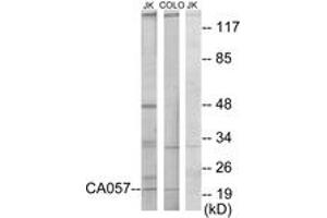 Western blot analysis of extracts from Jurkat/COLO205 cells, using C1orf57 Antibody.