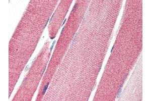 Human Skeletal Muscle (formalin-fixed, paraffin-embedded) stained with LGI4at 5 µg/ml followed by biotinylated goat anti-rabbit IgG secondary antibody, alkaline phosphatase-streptavidin and chromogen. (LGI4 antibody)