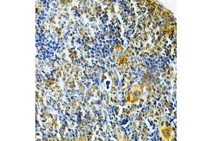 Immunohistochemistry of paraffin-embedded mouse spleen using GLRX Antibody (ABIN6127980, ABIN6141147, ABIN6141149 and ABIN6220940) at dilution of 1:200 (40x lens). (Glutaredoxin 1 antibody  (AA 1-106))