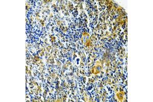Immunohistochemistry of paraffin-embedded mouse spleen using GLRX Antibody (ABIN6127980, ABIN6141147, ABIN6141149 and ABIN6220940) at dilution of 1:200 (40x lens). (Glutaredoxin 1 antibody  (AA 1-106))