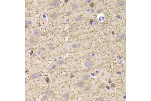 Immunohistochemistry of paraffin-embedded Rat brain using CNP antibody at dilution of 1:100 (x400 lens). (Cnpase antibody)