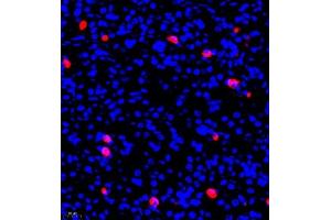 Immunofluorescence of paraffin embedded rat stomach using ghrelin (ABIN7074040) at dilution of 1:500 (400x lens) (Ghrelin antibody)