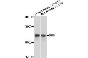 Western blot analysis of extracts of various cell lines, using DHH antibody (ABIN6292005) at 1:3000 dilution. (desert Hedgehog antibody)