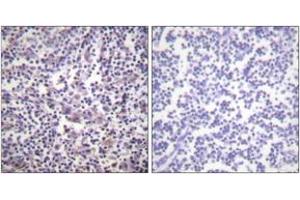 Immunohistochemistry analysis of paraffin-embedded human lymph node tissue, using B-RAF (Ab-601) Antibody. (SNRPE antibody  (AA 576-625))