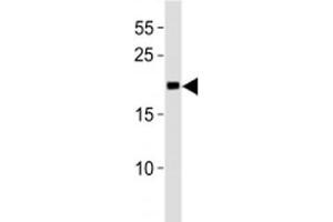 MGMT antibody western blot analysis in Jurkat lysate. (MGMT antibody  (AA 156-182))