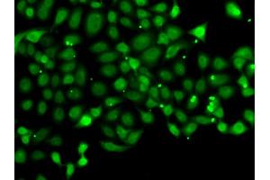Immunofluorescence analysis of MCF-7 cells using PDCD5 antibody (ABIN5974400).