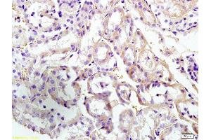 Formalin-fixed and paraffin embedded mouse kidney labeled with Anti-CUEDC2/CUE domain containing 2 Polyclonal Antibody, Unconjugated  at 1:300 followed by conjugation to the secondary antibody and DAB staining (CUEDC2 antibody  (AA 201-287))