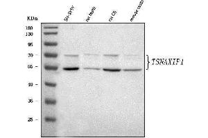 Western blot analysis of TSNAXIP1 using anti-TSNAXIP1 antibody (ABIN7599503).