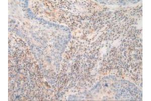 Figure. (PDXK antibody  (AA 29-253))