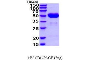 SDS-PAGE (SDS) image for Cathepsin A (CTSA) (AA 24-474) protein (His tag) (ABIN5854541)
