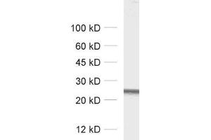 dilution: 1 : 1000, sample: rat brain homogenate (RAB5 antibody  (AA 182-196))