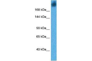 Host:  Rabbit  Target Name:  DMBT1  Sample Tissue:  Human Human Stomach  Antibody Dilution:  1ug/ml (DMBT1 antibody  (N-Term))