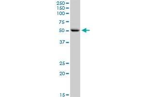 CNDP1 MaxPab rabbit polyclonal antibody. (CNDP1 antibody  (AA 1-507))