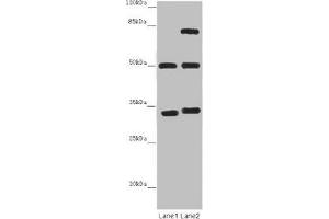 Western blot All lanes: TUBA1B antibody at 12 μg/mL Lane 1: Mouse brain tissue Lane 2: Mouse liver tissue Secondary Goat polyclonal to rabbit IgG at 1/10000 dilution Predicted band size: 51, 38 kDa Observed band size: 51, 34, 75 kDa (TUBA1B antibody  (AA 29-310))