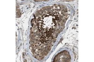 Immunohistochemical staining of human testis with VEZT polyclonal antibody  shows strong positivity in cells of ductus seminiferus. (VEZT antibody)