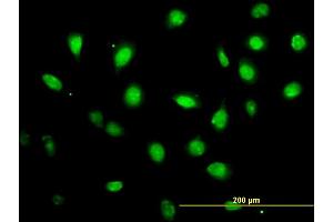 Immunofluorescence of monoclonal antibody to ZFYVE19 on HeLa cell. (ZFYVE19 antibody  (AA 1-396))