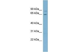 WB Suggested Anti-RPA1 Antibody Titration: 0. (RPA1 antibody  (Middle Region))