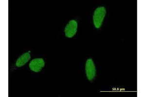 Immunofluorescence of purified MaxPab antibody to DCC1 on HeLa cell.
