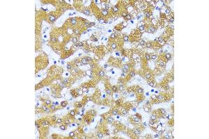 Immunohistochemistry of paraffin-embedded human liver using  antibody (ABIN6130862, ABIN6136444, ABIN6136445 and ABIN6216549) at dilution of 1:100 (40x lens). (Acox2 antibody  (AA 1-150))