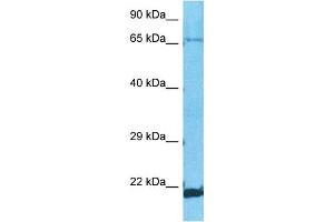 Host:  Rabbit  Target Name:  ZNF8  Sample Type:  A549 Whole Cell lysates  Antibody Dilution:  1.