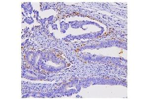 IHC analysis of STAT1 using anti STAT1 antibody (ABIN6719375).