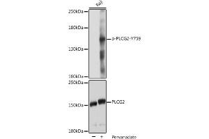 Western blot analysis of extracts of Raji cells, using Phospho-PLC gamma 2 (PLCG2)-Y759 pAb (ABIN7269341) at 1:2000 dilution or PLC gamma 2 (PLCG2) antibody (ABIN3023144, ABIN3023145, ABIN3023146 and ABIN6219411). (Phospholipase C gamma 2 antibody  (pTyr759))