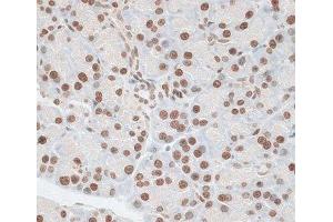 ZNF177 antibody