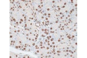 Immunohistochemistry of paraffin-embedded Rat pancreas using ZNF177 Polyclonal Antibody at dilution of 1:100 (40x lens).