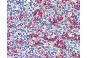 Human spleen; Anti-ZNF71 antibody IHC staining of human spleen. (ZNF71 antibody)