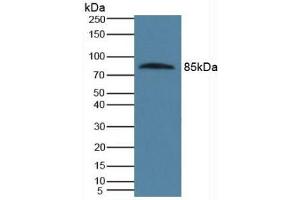 Detection of PROS in Human Serum using Polyclonal Antibody to Protein S (PROS) (PROS1 antibody  (AA 481-667))