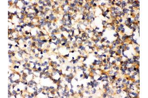 Anti- PAK5 Picoband antibody, IHC(P) IHC(P): Human Glioma Tissue (PAK7 antibody  (N-Term))