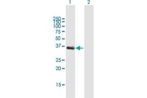 Western Blot analysis of AKR1C1 expression in transfected 293T cell line by AKR1C1 MaxPab polyclonal antibody. (AKR1C1 antibody  (AA 1-323))