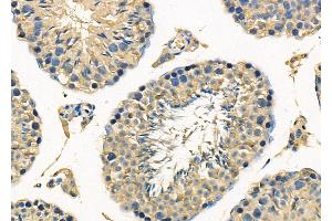 ABIN6263024 and ABIN6278127 at 1/100 staining Mouse testis tissue by IHC-P. (Lactoferrin antibody  (C-Term))